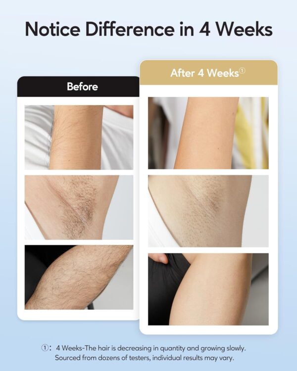 INNZA Laser Hair Removal with Ice Cooling Care Function for Women - Image 3